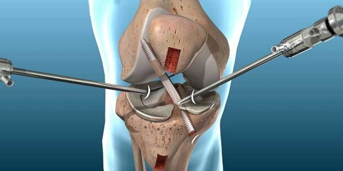Preventing Complications After Joint Reconstruction - What You Should Know?