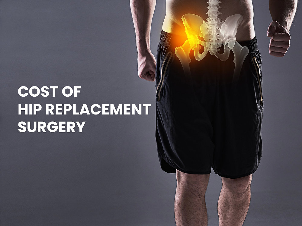 What is the cost of hip replacement surgery in India?