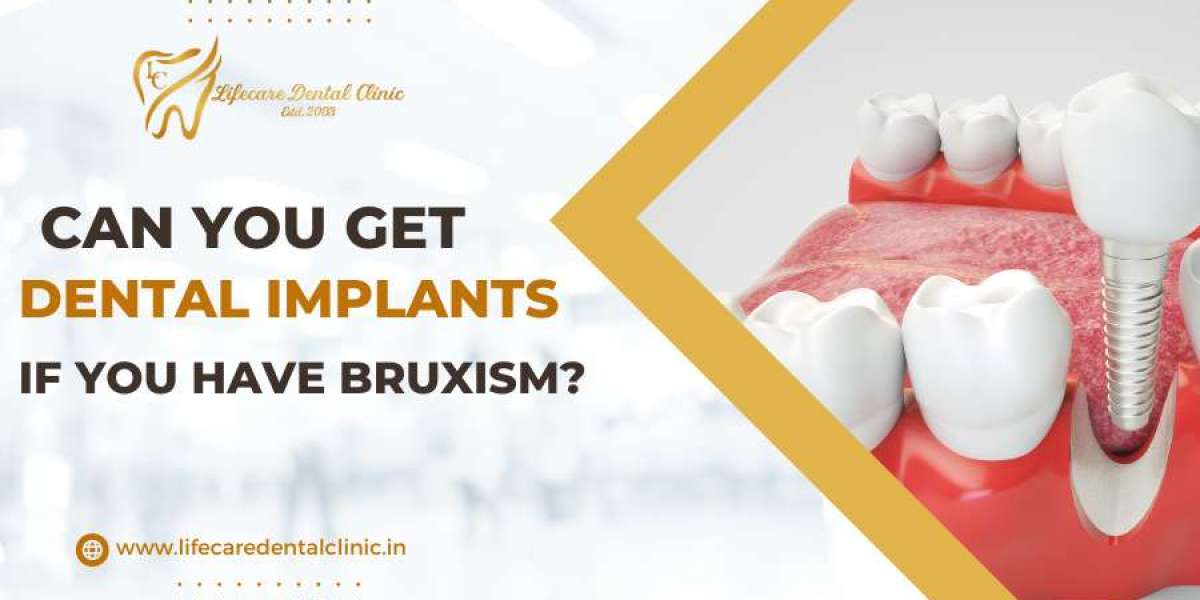 Can You Get Dental Implants If You Have Bruxism?