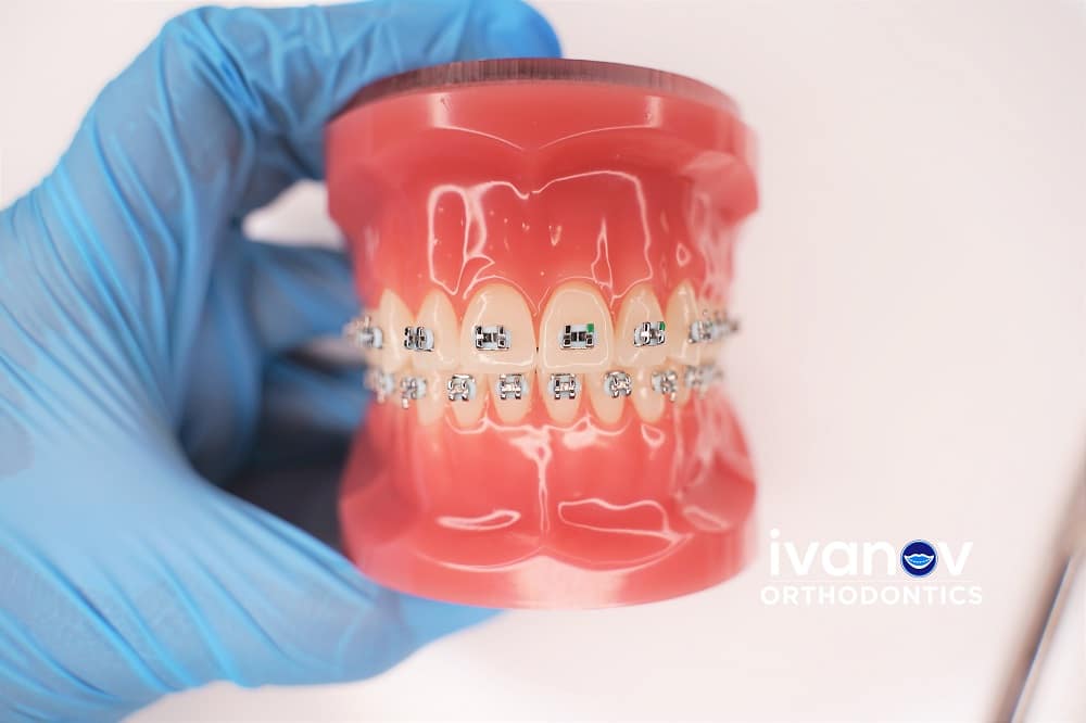 Miami Orthodontic Specialists | Orthodontic Specialists Of Florida